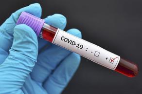 Число инфицированных COVID-19 в Азербайджане увеличилось до 21 916