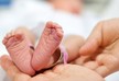 В Португалии родился ребенок без лица