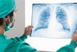 Oncologists name symptom of lung cancer