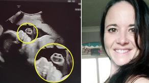 ორსულმა ქალმა ექოსკოპიის სურათზე ბავშვის გვერდით იდუმალი სახე დაინახა