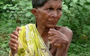Indian woman with 19 toes and 12 fingers considered witch - PHOTO