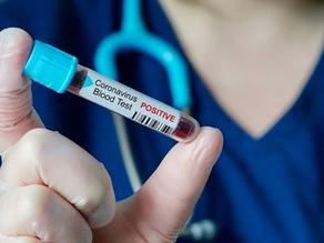Georgia reports four recently confirmed coronavirus cases