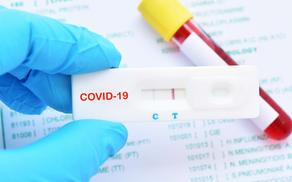 ПЦР-тест может не обнаружить новый штамм COVID-19