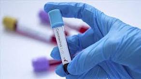 Azerbaijan registers single-day spike of 526 coronavirus cases