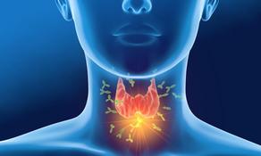 По мнению врачей, SARS-CoV-2 вызывает воспаление щитовидной железы