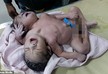 Baby with two heads and three arms is born in India - PHOTO