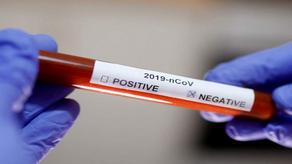 26 people cured of coronavirus in Georgia