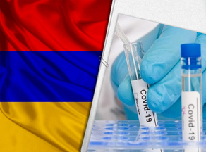 В Армении выявлено 672 новых случаев инфицирования COVID-19