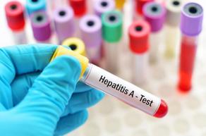 15 children hospitalized for hepatitis A in Ukraine