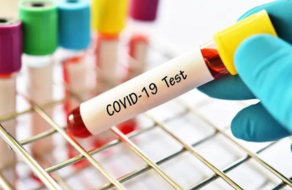 Number of infected with coronavirus increases to 73