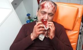 Zviad Kuprava callously beaten near his house - PHOTO
